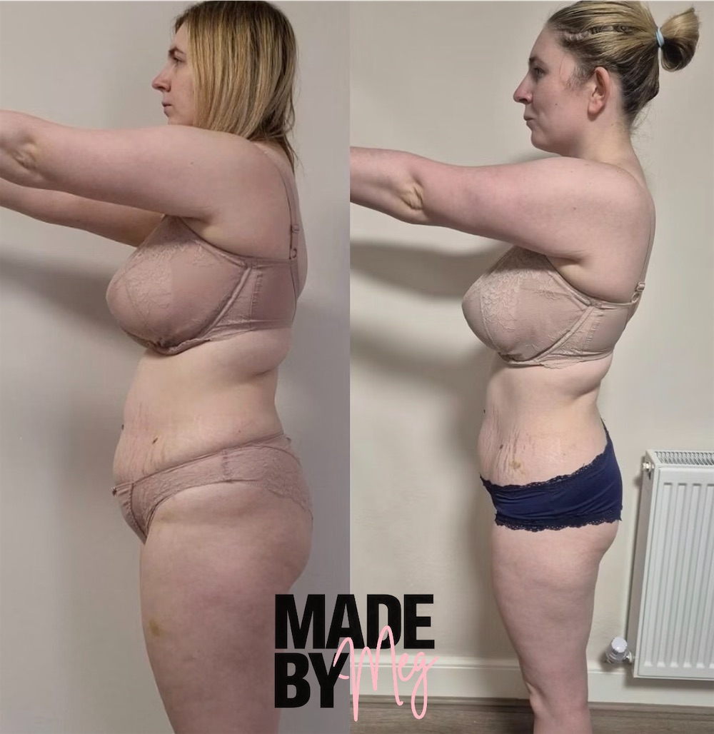 Client before and after, side view