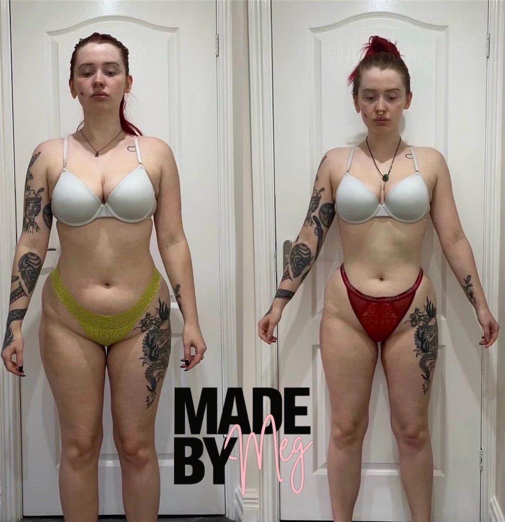 Client before and after, front view